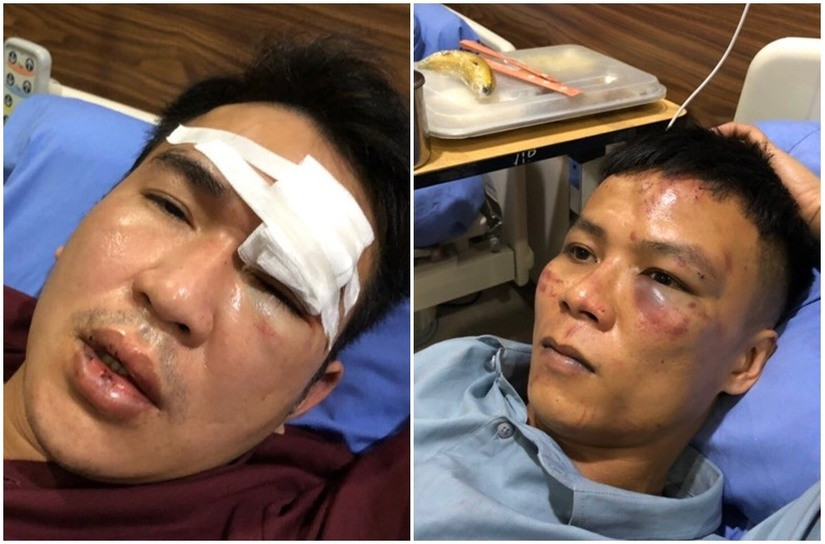 Nhom con do hanh hung khien 2 nhan vien quan hat chan thuong so nao-Hinh-2