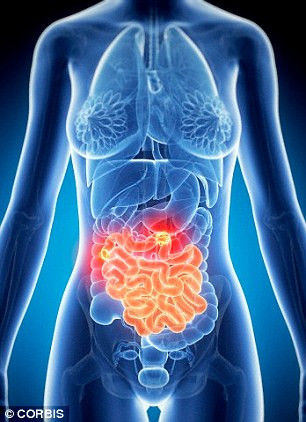 Một trong những bài kiểm tra sức khỏe quan trọng cần phải làm là khám nghiệm vùng bụng, đặc biệt là phụ nữ, đàn ông từ tuổi 60 trở lên. Thực hiện cuộc kiểm tra này sẽ giúp tìm ra những dấu hiệu chảy máu bất thường, cảnh báo đầu tiên của ung thư bụng.