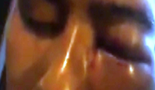 Can bo Ngan hang Agribank “tu ve”, nguyen chien si Cong an suyt mu mat