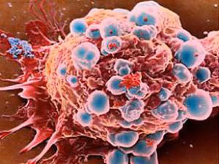  Đáng lưu ý, thành phần tạo mùi thơm là những hợp chất benzen. Khi đốt cháy, chất độc sẽ kích thích tác động liên kết bề mặt của đường hô hấp dẫn đến viêm hô hấp mãn tính, phá hủy các tổ chức cơ thể dẫn đến biến đổi tế bào, biến đổi gen gây ra hiện tượng dị sản, loạn sản. Khi là tế bào ác tính, chúng sẽ biến thành tế bào ung thư. 