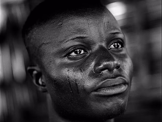 Hiện nay, một số quốc gia Tây Phi đã cấm hủ tục này bởi nó tiềm ẩn sự nguy hiểm và vi phạm quyền trẻ em nghiêm trọng. Tuy nhiên, trong tâm thức của người dân ở bộ lạc Betamarrie, họ cho rằng những vết sẹo trên mặt là niềm tự hào và kiêu hãnh.