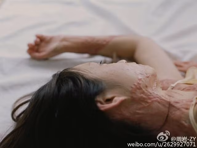 Mặc dù vậy, bố mẹ Tao sau đó đã từ chối trả tiền viện phí cho Zhou trừ khi gia đình cô ký đơn đề nghị thả con trai của họ.