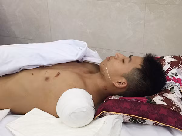 Sau vụ tai nạn, cả Huy và Quân được đưa đến khoa Chấn thương chỉnh hình, bệnh viện Việt Đức để phẫu thuật, cứu chữa. Khi Huy tỉnh lại, đã có rất nhiều người đến thăm hỏi và cập nhật tình hình sức của khỏe của cậu. Trên mạng, suốt những ngày qua tràn ngập những dòng chia sẻ thể hiện sự cảm kích của các bạn trẻ trước tấm lòng, sự hy sinh đáng trân trọng của Huy. Bản thân Huy cũng đã có một vài chia sẻ về hành động của mình trong một đoạn clip ngắn được chia sẻ công khai trên mạng xã hội. Ảnh: Dân Việt.