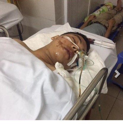 Hiện tại Huy đã tỉnh và nói chuyện được với mọi người. Bạn bè, người thân của cậu thường xuyên túc trực ở bên để theo dõi và trò chuyện, củng cố tinh thần cho chàng trai dũng cảm nhưng lại gặp chuyện không may.