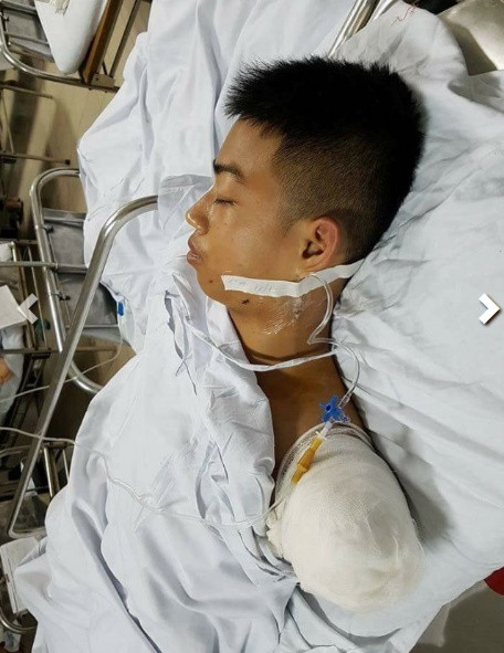 Sau tai nạn, cả Quân và Huy được đưa đến bệnh viện Việt Đức cấp cứu. Không ai thiệt mạng nhưng Huy đã bị mất một cánh tay và gặp phải nhiều chấn thương nghiêm trọng khác trên cơ thể. Theo lời kể của những người bạn của Huy và Quân, Huy sinh năm 1997, quê ở Diễn Châu, Nghệ An. Khi tỉnh dậy, biết mình đã bị mất một cánh tay nhưng người bạn đồng hành của mình là Quân vẫn giữ được tính mạng, Huy không hề tỏ ra đau đớn hay suy sụp tinh thần. Ngược lại chàng trai Nghệ An còn tỏ ra rất lạc quan. Huy cho rằng nếu đó không phải cánh tay của cậu thì đã là đầu của Quân rồi, cánh tay mất đi cũng không sao nhưng để Quân bị xe cán qua đầu thì chắc chắn bỏ mạng.