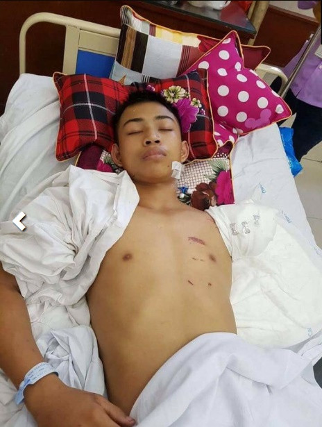 Mới đây, đông đảo cư dân mạng Việt đã tỏ ra rất xúc động và cảm phục một chàng trai Nghệ An tên Huy trong câu chuyện "cánh tay thiên thần", hy sinh cánh tay cứu bạn thoát chết trong một vụ tai nạn giao thông ở Hà Nội. Cụ thể theo thông tin lan truyền trên mạng, 3h sáng ngày 22/11, Quân và Huy đang cùng nhau đi xe máy, bị một xe đi đối diện chiếu đèn pha gây lóa mắt nên Quân lái xe bị đâm vào một ô tô đang đỗ. Huy và Quân cùng ngã xuống đường trong khi phía sau có một chiếc ô tô đang lao đến. Trong tình thế cấp bách, Huy vẫn quan sát được đường bánh xe sẽ đi qua vị trí đầu của Quân đang nằm trên đường nên đã gắng gượng kéo đầu bạn ra thật nhanh và dùng luôn cánh tay của mình thế vào chỗ bánh xe cán qua.