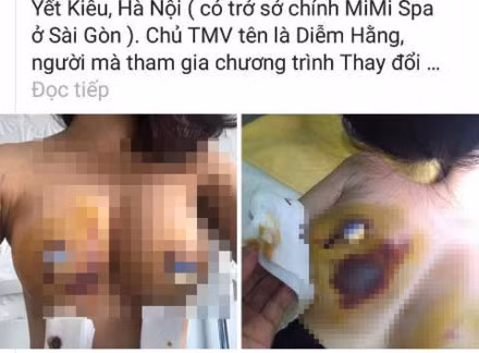 "Nat nguc” vi nang cap vong 1: Benh vien TM Kim Cuong to nguoc-Hinh-2