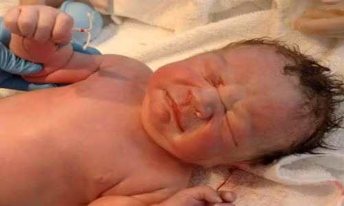 Lam sao da dat vong ma van co thai binh thuong