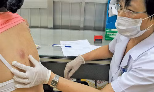 Ra sức “hành hạ” u lành tính, nhận cái kết thảm Ra suc “hanh ha” u lanh tinh, nhan cai ket tham