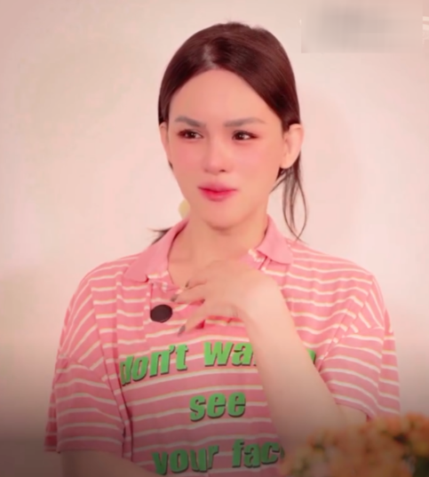 Tuy nhiên, do mới phẫu thuật, mũi và mí mắt của anh chàng vẫn còn dấu hiệu sưng tấy.