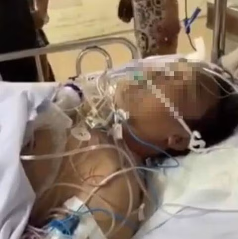 Can mat ke cam dau vung dao chem chet giang ho Quan 