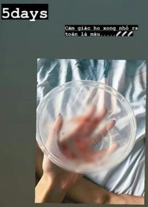 Nữ diễn viên chỉ còn nặng 42kg, ho ra máu. Ảnh: FB Khả Ngân.