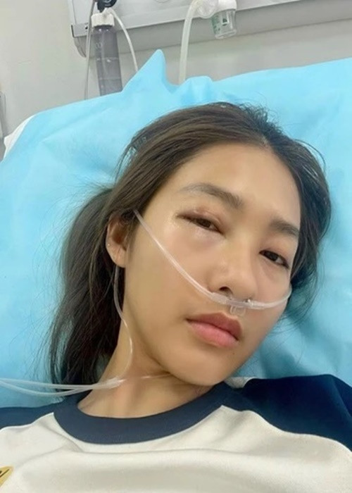 Theo Tiền Phong, 2 tuần trước, Khả Ngân làm tiểu phẫu loại bỏ phần cứng trong mắt. Cô không uống thuốc giảm đau vì bị dị ứng thuốc. Tuy nhiên, sau khi hết thuốc tê, vùng mắt của Khả Ngân tiếp tục đau. Nữ diễn viên sử dụng thuốc kháng viêm dạng men có công dụng chống phù nề sau chấn thương, phẫu thuật. Ảnh: Znews.