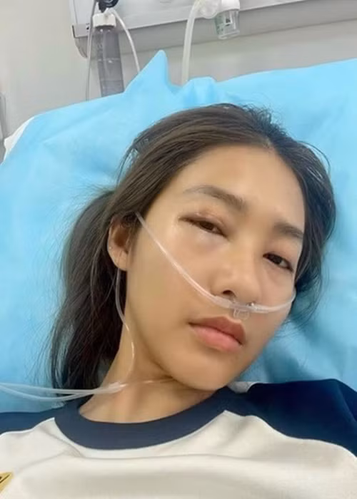 Dien vien Kha Ngan bi soc phan ve, phai nhap vien cap cuu