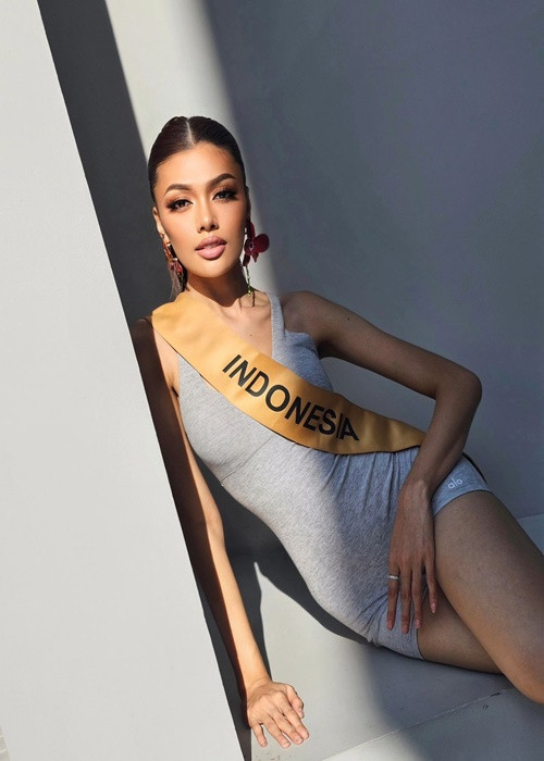 Sau khi giành vương miện, người đẹp vướng nghi vấn "dao kéo" vùng mắt, mũi, cằm. Ảnh: Instagram Nova Liana.