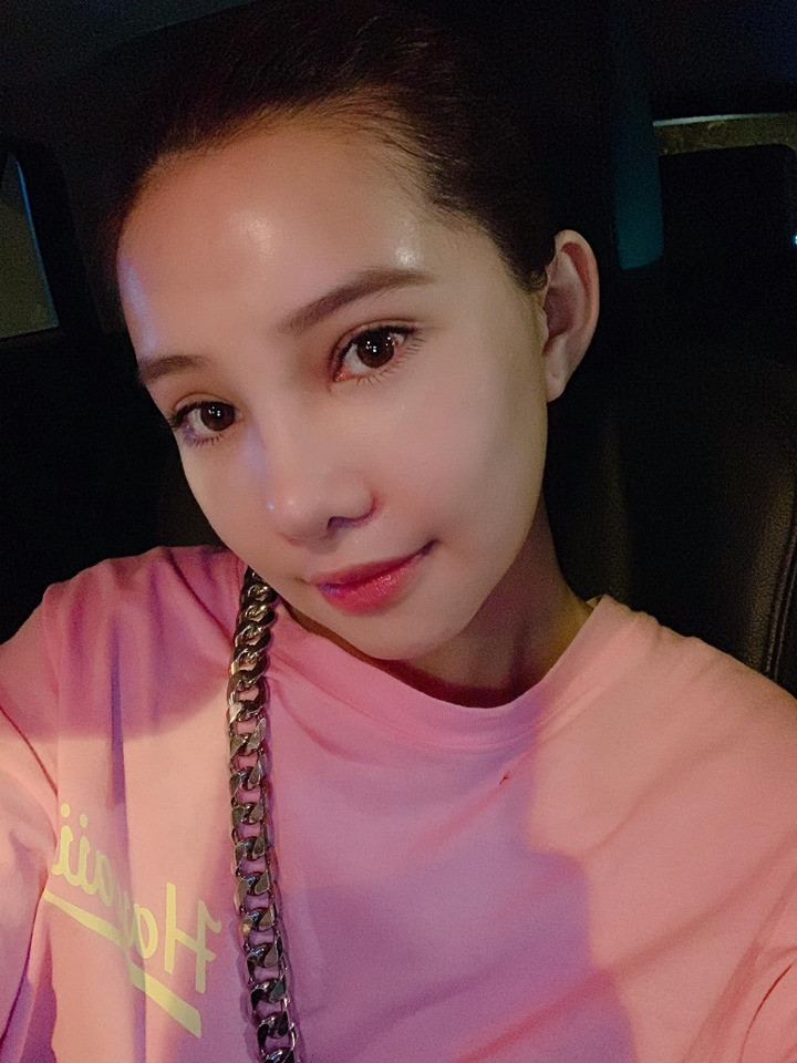 Gương mặt nữ diễn viên Lưu Đê Ly đã ổn hơn sau nửa tháng phẫu thuật.