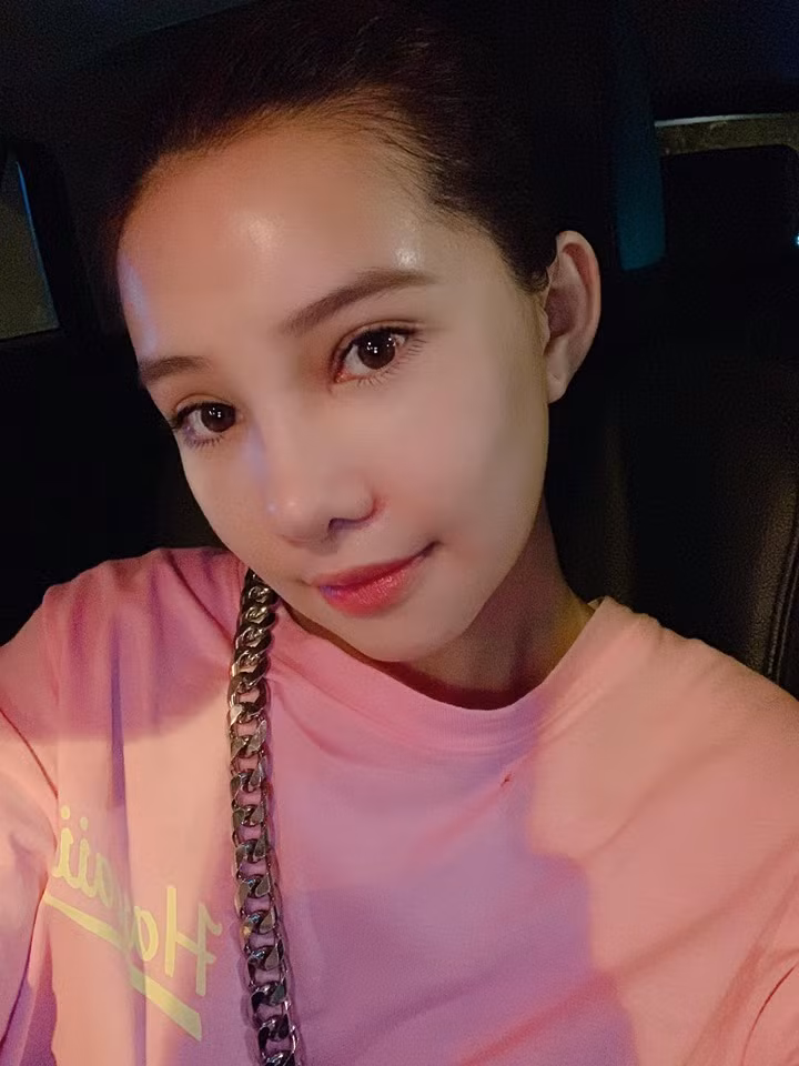 Gương mặt nữ diễn viên Lưu Đê Ly đã ổn hơn sau nửa tháng phẫu thuật.