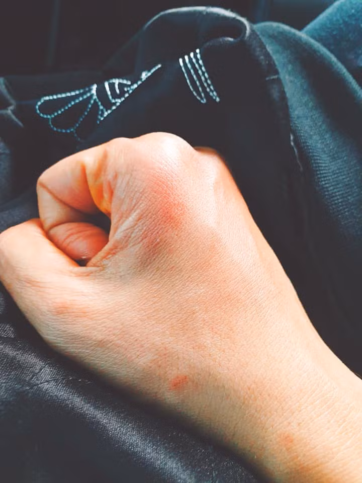 Ngo Thanh Van bi chan thuong khi dong phim o Anh-Hinh-3