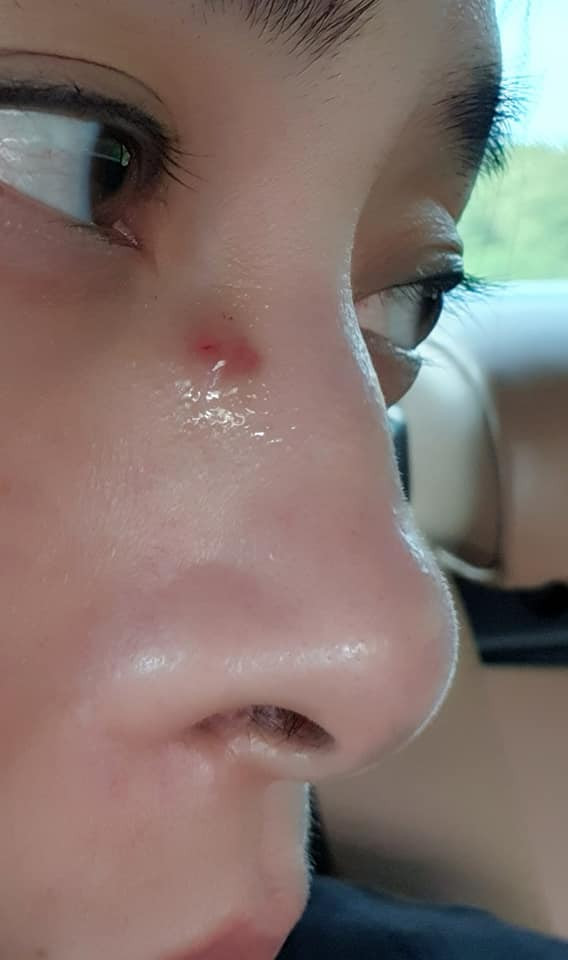 Ngo Thanh Van bi chan thuong khi dong phim o Anh-Hinh-2