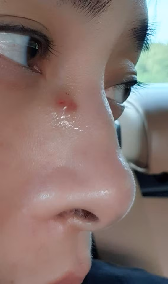 Ngo Thanh Van bi chan thuong khi dong phim o Anh-Hinh-2