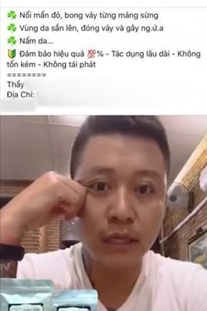 Tuan Hung bi loi dung hinh anh quang cao thuoc chua benh da lieu