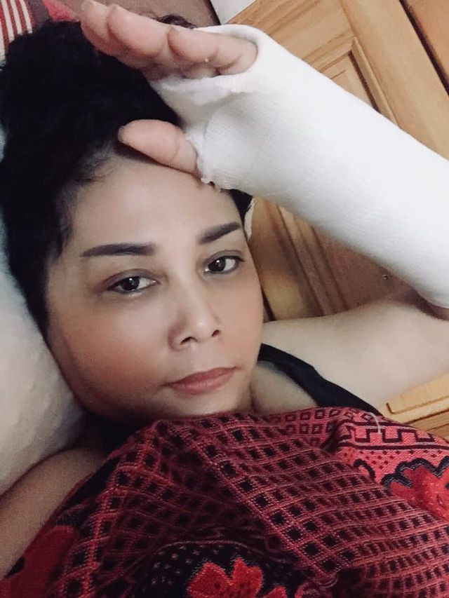 Nghe si Minh Hang bi nga gay tay phai bo bot van hai huoc