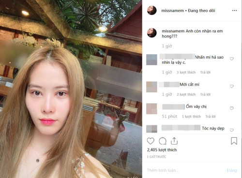 Nhìn lại trước đó, Hoa khôi Nam Em hốc hác, vêu vao và mắt sưng như mới cắt mí.