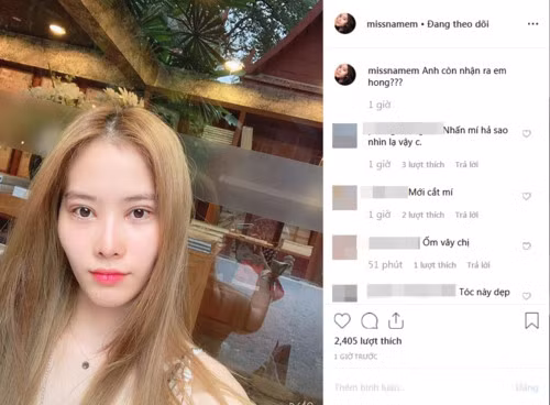 Nhìn lại trước đó, Hoa khôi Nam Em hốc hác, vêu vao và mắt sưng như mới cắt mí.