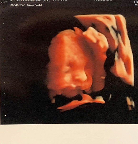 MC Phuong Mai dien noi y khoe bung bau-Hinh-2