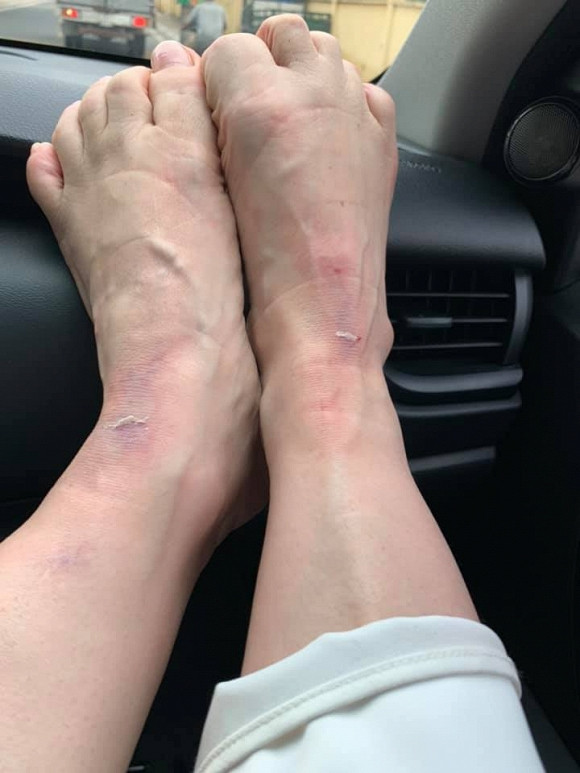 Trước sự quan tâm của dân mạng, nữ ca sĩ trấn an: "Hai không sao hết. Cả nhà an tâm đừng lo. Hết xui rồi đó...".