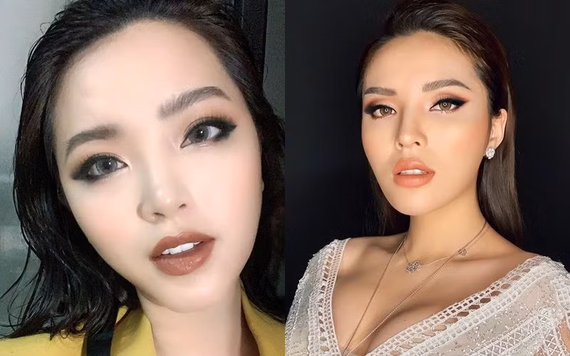 Bi nghi sua mat sau sinh mo lan 3, Hai Bang dap tra-Hinh-3