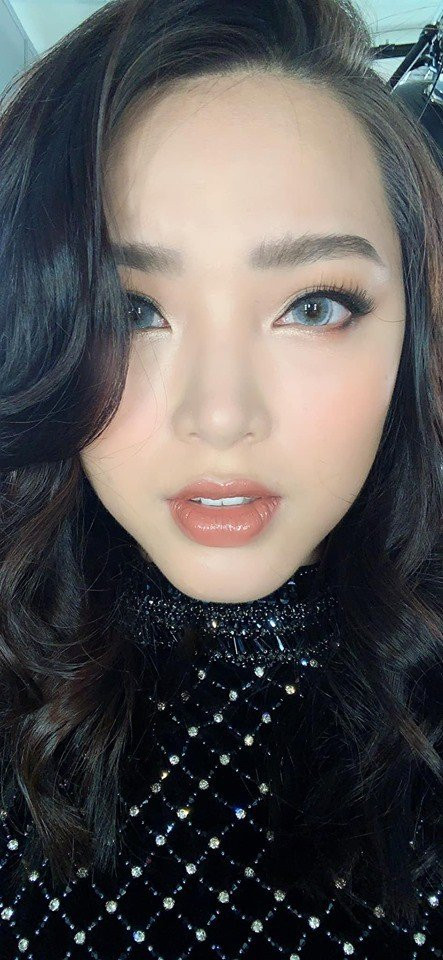 Bi nghi sua mat sau sinh mo lan 3, Hai Bang dap tra-Hinh-5