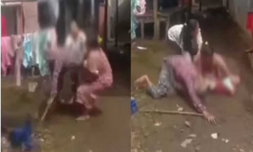 Bi mang luoi bieng, chau dau khien ba so hai tot do