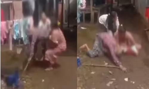 Bi mang luoi bieng, chau dau khien ba so hai tot do