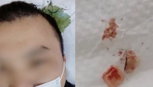 Mui hoi thoi boc len tu dinh dau, phat hien chuyen kinh di