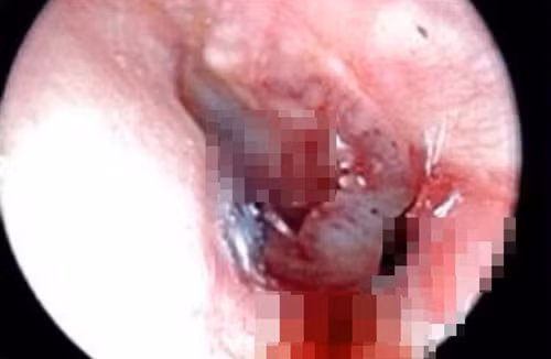 Bạn gái đòi yêu kiểu lạ, người đàn ông gặp họa đáng sợ Ban gai doi yeu kieu la, nguoi dan ong gap hoa dang so