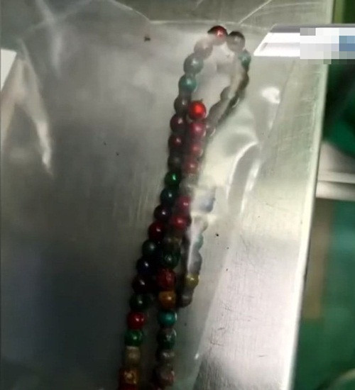 Nghich do cua anh, be gai khien bac si lac dau kho cuu