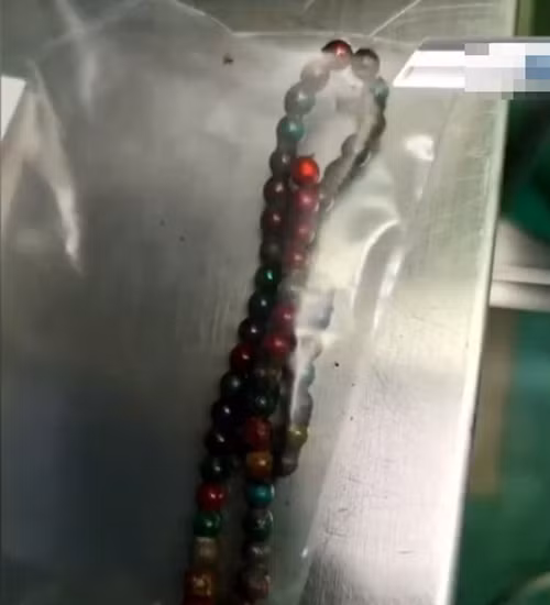 Nghich do cua anh, be gai khien bac si lac dau kho cuu