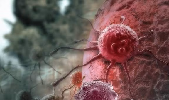 4 trieu chung noi nhau xuat hien, ung thu den rat gan