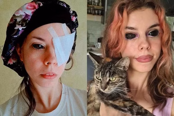 Xam mat quy, co gai mat luon nhan cau