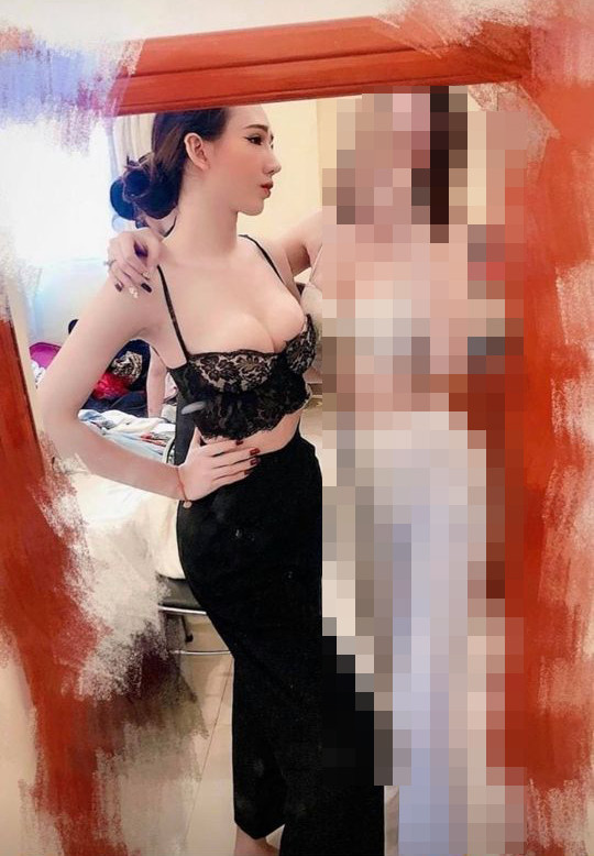 Các đường nét trên gương mặt của Minh Anh dần hài hòa hơn sau nhiều năm chuyển đổi giới tính.