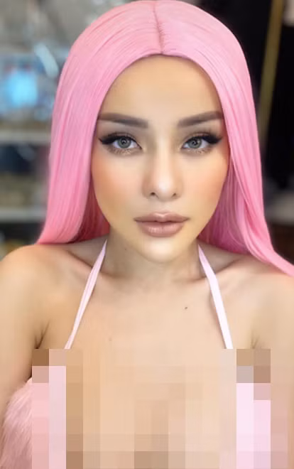 Hình ảnh mới nhất của Ngân 98 trong đôi môi khác lạ khiến nhiều người đồn đoán cô đang động chạm "dao kéo" trên gương mặt.