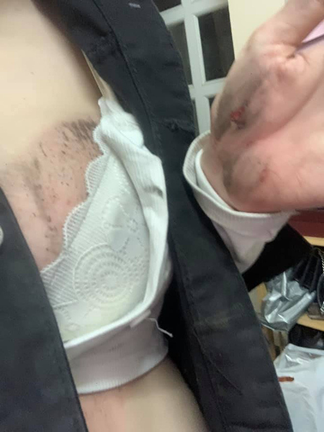 Do rạng sáng đường vắng nên tên cướp đã tẩu thoát mà không ai đuổi theo kịp. Linh Hana sau đó được bạn bè đưa về nhà và sát khuẩn những vết thương.