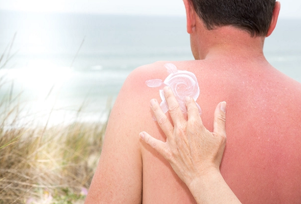 Bao dong so ca mac ung thu da o nam gioi mua nang nong