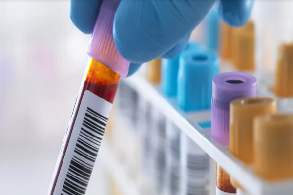 Muc do con trong mau anh huong den co the ra sao?