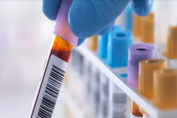 Muc do con trong mau anh huong den co the ra sao?