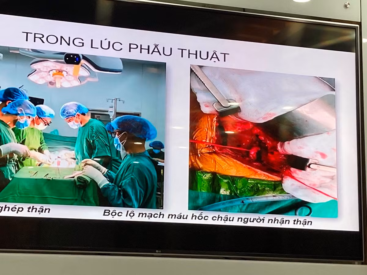 BV Chợ Rẫy nói gì về thông tin “hết thuốc cho bệnh nhân sau ghép thận”? - Hình 2 BV Cho Ray noi gi ve thong tin “het thuoc cho benh nhan sau ghep than”?-Hinh-2