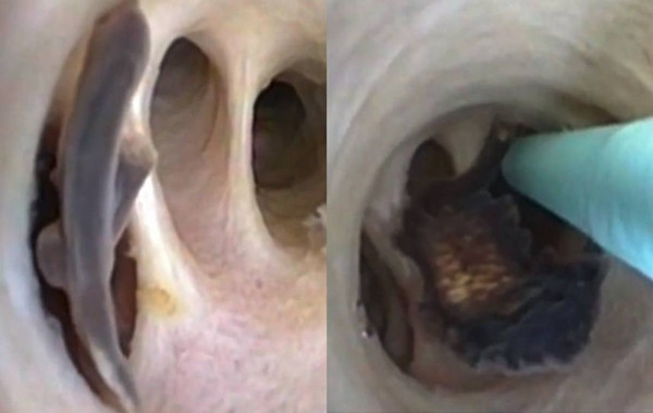 An ca kieu nay, nguoi dan ong khien bac si run ray