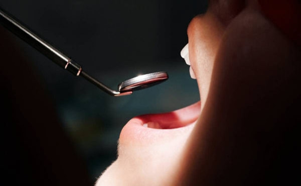 Hoi mieng nua nam, di kham nao ngo benh ung thu quai ac