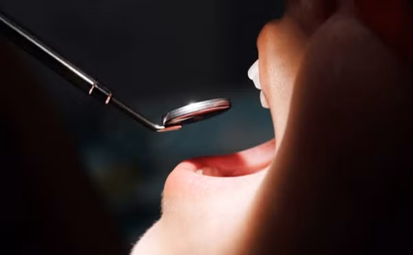 Hoi mieng nua nam, di kham nao ngo benh ung thu quai ac